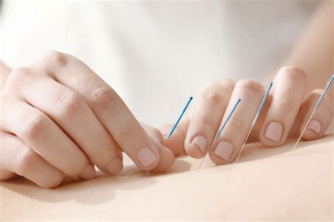 Why Cancer Patients Should Consider Acupuncture - Health News Hub