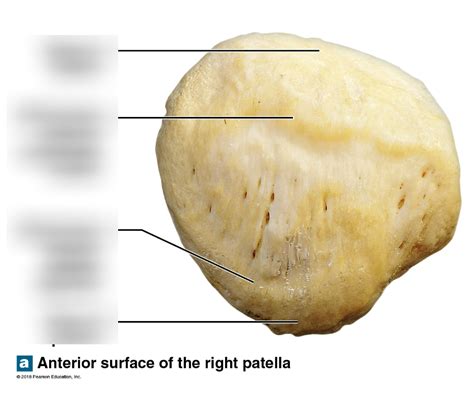 Patella Bone Diagram Diagram | Quizlet