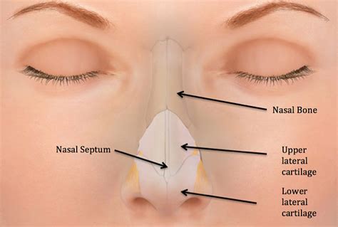 Deviated Septum Diagram