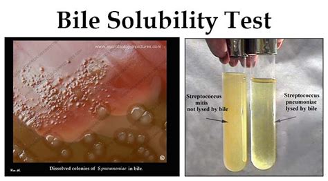 Bile Solubility Test- Principle, Reagents, Procedure and Result Interpretation