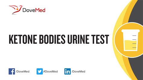 Ketone Bodies Urine Test