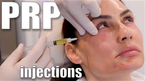 PRP Injections to Face and Neck (Blood Facial) - YouTube