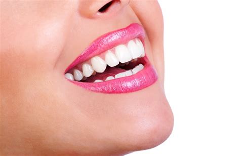 Teeth Whitening Near Me - Identity Dentistry Canberra City