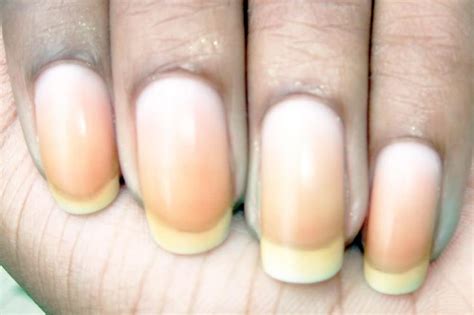 What Causes Nail Discoloration & How to Treat It | We Heart Nails