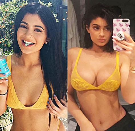 Did Kylie Jenner Get Breast Implants? See Before & After Photos ...