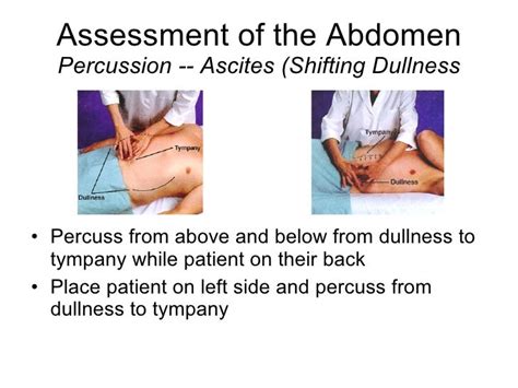 Acute Abdomen