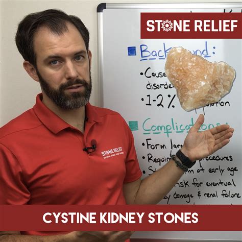 Cystine Kidney Stones