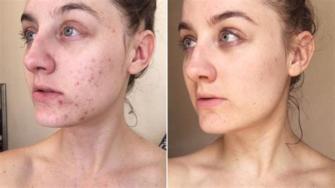 This Woman Swapped Her Cleanser for Micellar Water — and the Results Are SHOCKING | Micellar ...