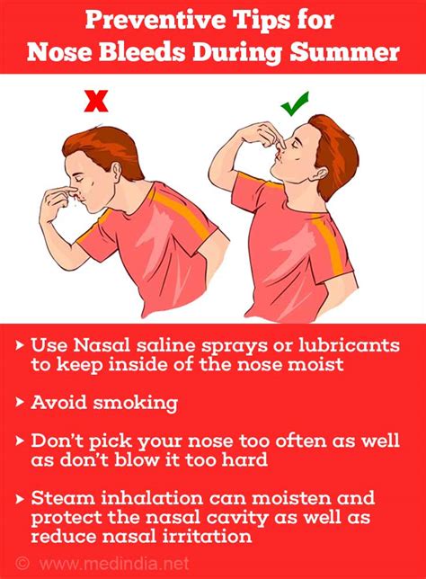 How To Help A Nosebleed - Gameclass18