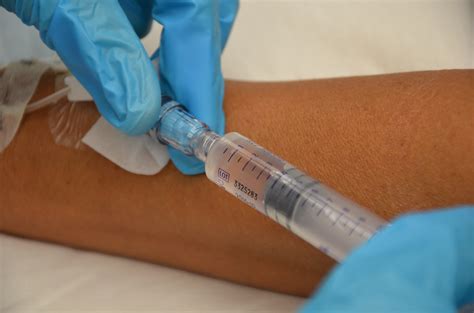 8.6 Converting an IV Infusion to a Saline Lock and Removal of a Peripheral IV – Clinical ...