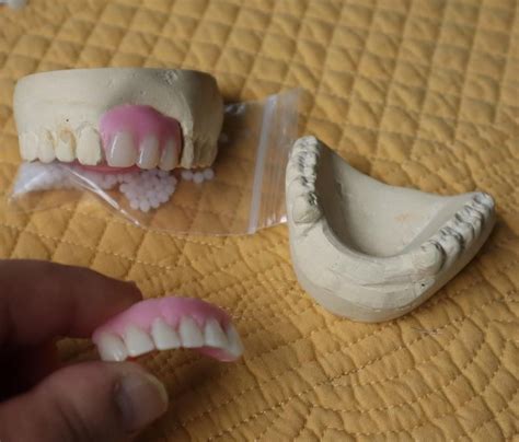 diy partial denture repair - Carmen Ellington