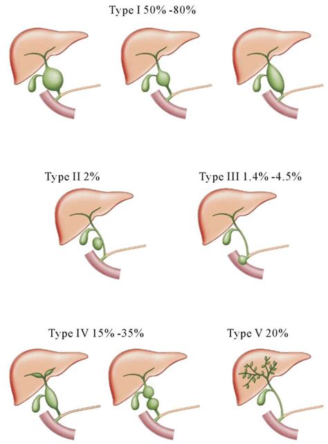 Pin on Surgery