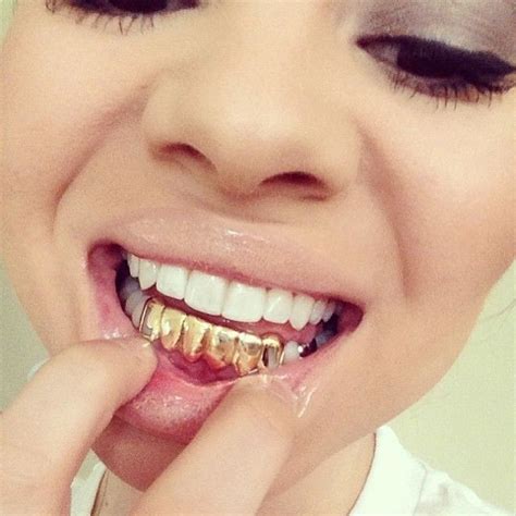 Air Miles Gold Mastercard Canada: Gold Teeth Dentures