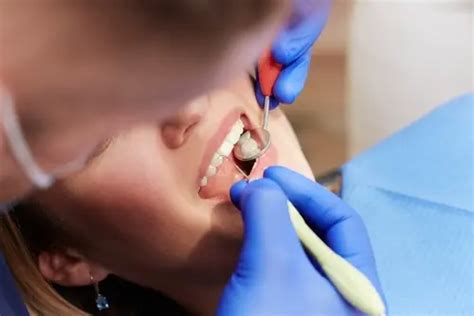 Cavity Prevention - Ways to Prevent Tooth Decay and Cavities