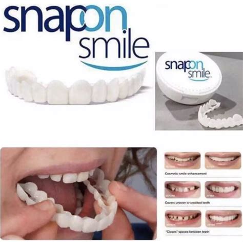 Snap On Smile Teeth One Size Fits Snapon Snap-on Smile | Lazada PH