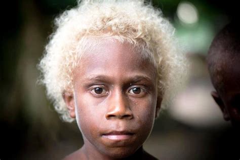 Rare Phenomenon: Melanesians with Dark Skin and Blond Hair
