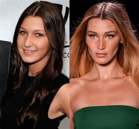 Bella Hadid plastic surgery: Before and after | WHO Magazine Bad ...