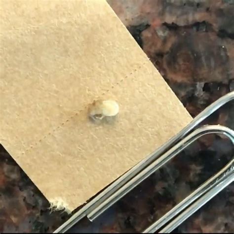 What species of ostracod is this? : r/whatsthisbug