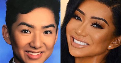 Nikita Dragun's Plastic Surgery Journey — Before and After