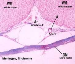 arachnoid mater spinal cord histology - Google Search in 2020 | Spinal cord, Spinal, Arteries