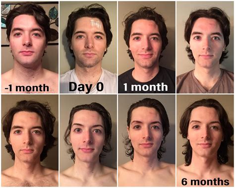 MtF 6 months HRT!!! 26yo in about 1 week! : transtimelines | Chicas ...