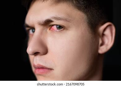 Close One Annoyed Red Blood Eye Stock Photo 2167098705 | Shutterstock