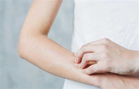 Burning sensation on skin: symptoms, causes, prevention, diagnosis, treatment