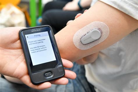 Dexcom's Glucose Monitoring Wearable System Receives CE Mark in the Europe