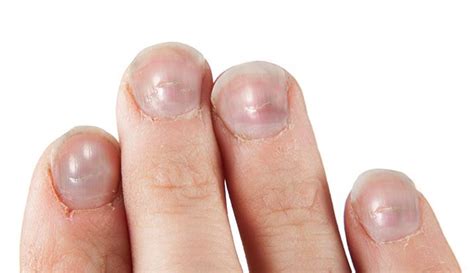 Fingernails And Health Signs – 10 Signs That Could WOC Print | lupon.gov.ph