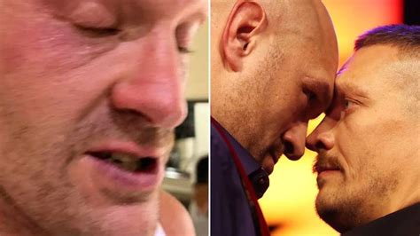 Tyson Fury breaks his silence after Oleksandr Usyk postponement and shows off facial injury - News