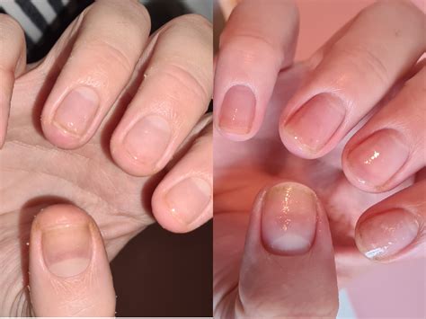 3 week nail bed growth! : r/calmhands