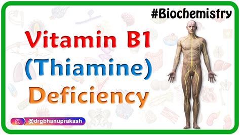 Vitamin B1 (Thiamine) Deficiency - USMLE Biochemistry Vitamins Case ...