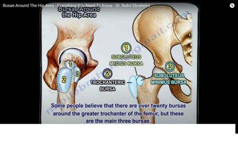 Bursae around the Hip Region — OrthopaedicPrinciples.com