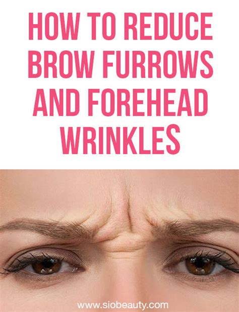 Brow Furrow: How To Smooth Your Brow And Forehead