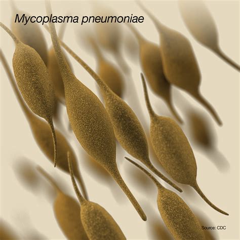 Mycoplasma Pneumoniae Infections - StoryMD