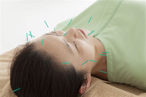 Facial Rejuvenation or Cosmetic Acupuncture - Pearl Acupuncture