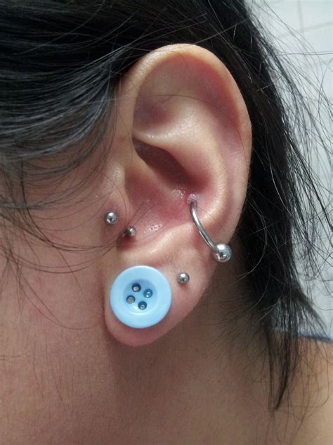 Infected Ear Lobe Piercing Bump