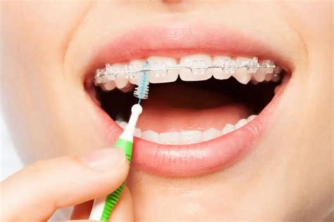 Interdental Brushes: Best Brands, Sizes & How to Use Them