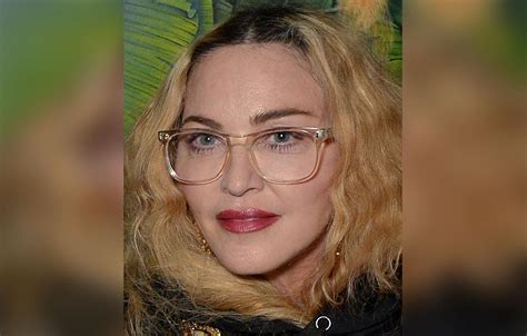 Madonna's Shocking Plastic Surgery Makeover Exposed By Top Docs