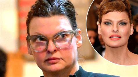 Linda Evangelista before and after surgery