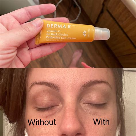 Derma-E dark circle eye cream, immediate results. : r/SkincareAddicts