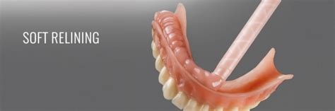 Denture Soft Liners Ottawa | Ottawa Denture and Implant Denture Clinic