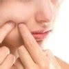 Información acerca del acné, Dudas más usuales sobre el acné