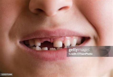 3,781 Toothless Kid Smiling Stock Photos, High-Res Pictures, and Images ...