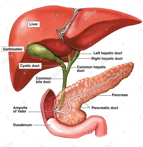 Cholecystectomy