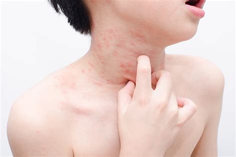 Skin Rashes In Children: Causes, Treatment And Prevention