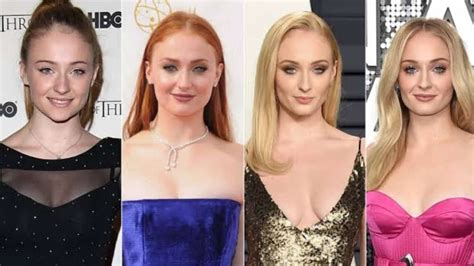 Sophie Turner's Before And After Look: The GOT Actress Sparks Plastic ...