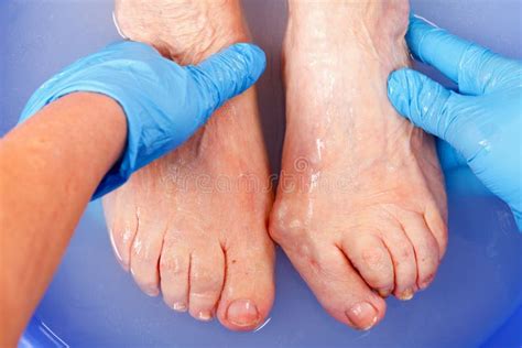 Foot care stock photo. Image of barefoot, medicine, doctor - 62788298