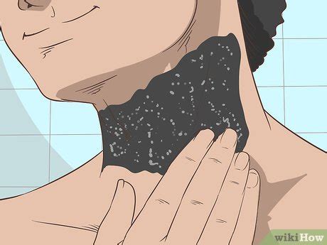 3 Ways to Prevent Ingrown Hairs on Your Neck - wikiHow