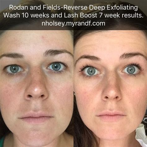 Reverse Deep Exfoliating Cleanser and Lash Boost. Before and After Rodan and Fields nholsey ...